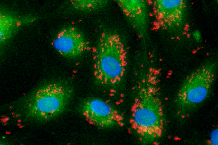 血管内皮細胞（細胞質：緑、核：青）の中に感染するバルトネラ・ヘンセレ（赤）。